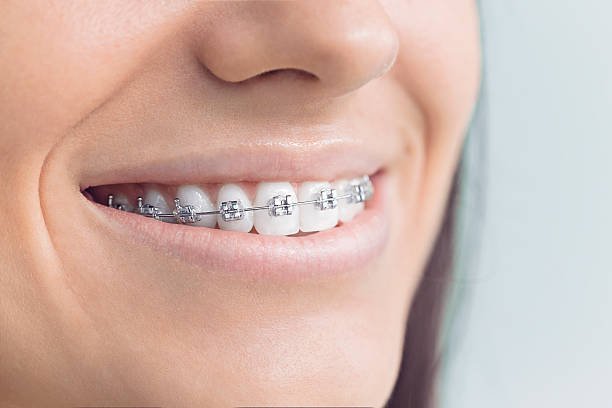 Best Oral Cancer Screening  in Kissimmee, FL